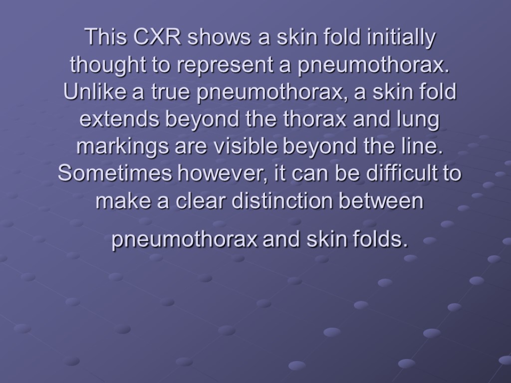 This CXR shows a skin fold initially thought to represent a pneumothorax. Unlike a